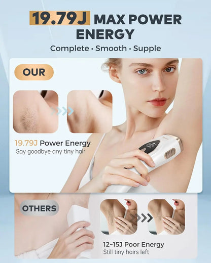 GlowBare Ice-Cool Laser Hair Remover