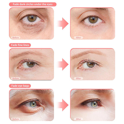 EyeRenew EMS Massager Glasses – Red Light Therapy for Dark Circles & Puffiness